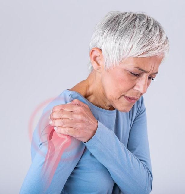 Lesione cuffia dei rotatori: cause degenerative