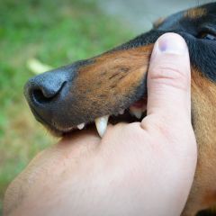Morso alla mano: cosa fare