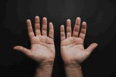 Nodulo o “pallina” sul palmo della mano